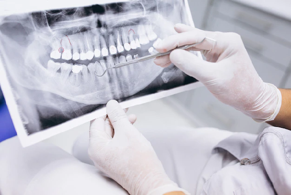 Dental X Ray