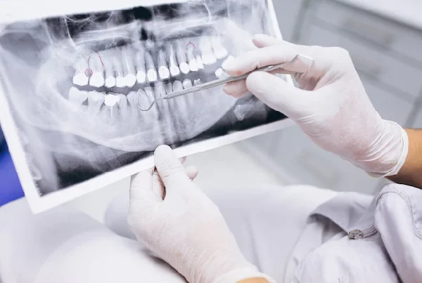 Dental X Ray
